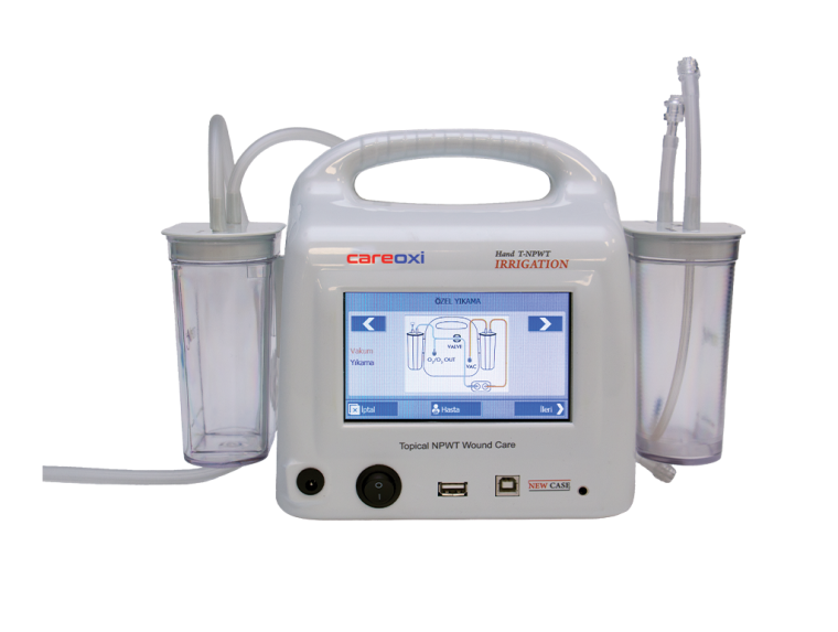 Điều trị áp lực âm
