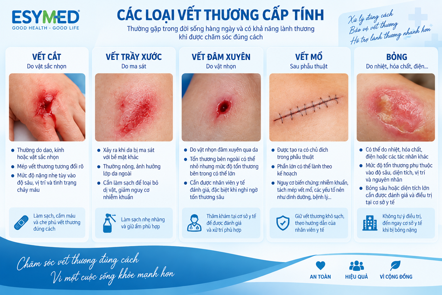vết thương cấp tính